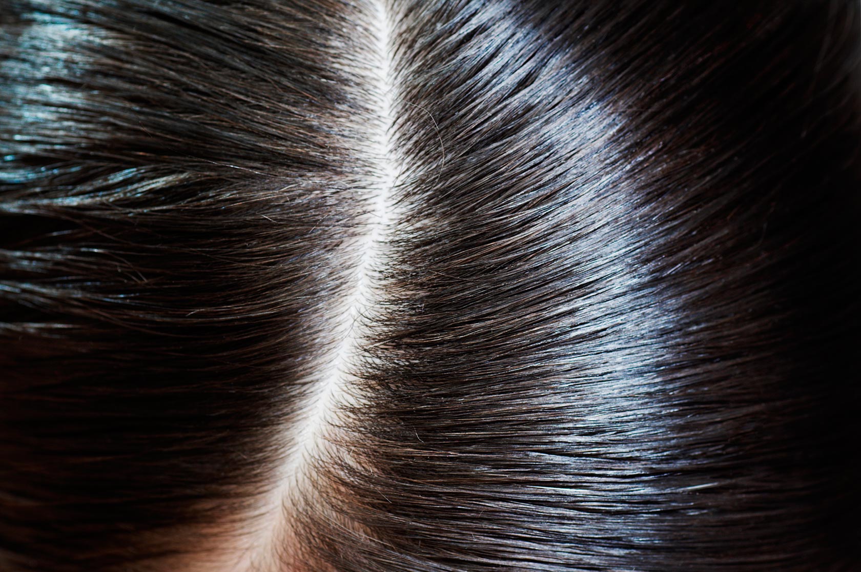 What is the way to get rid of nits?