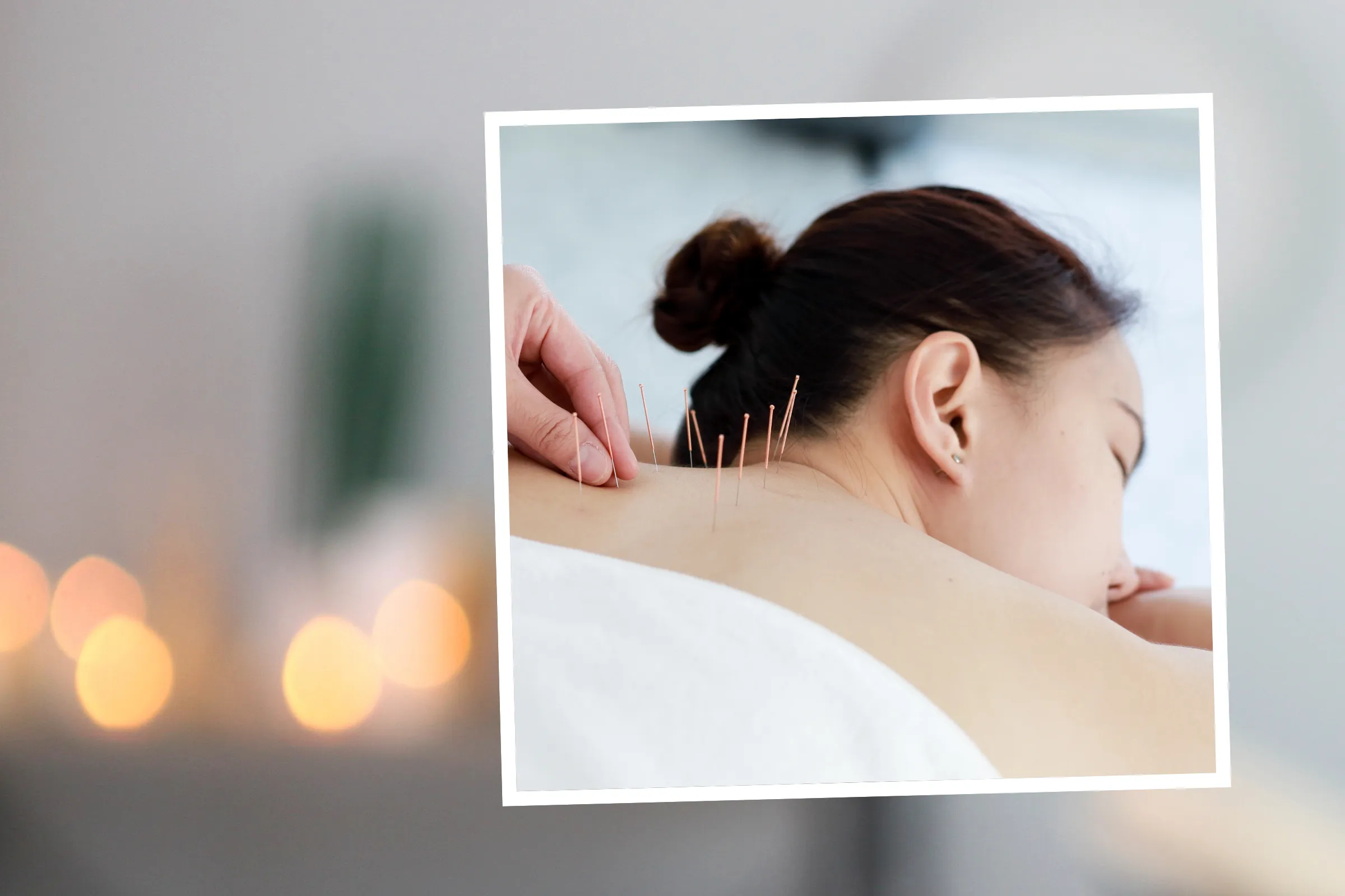 What happened when I tried acupuncture for the first time