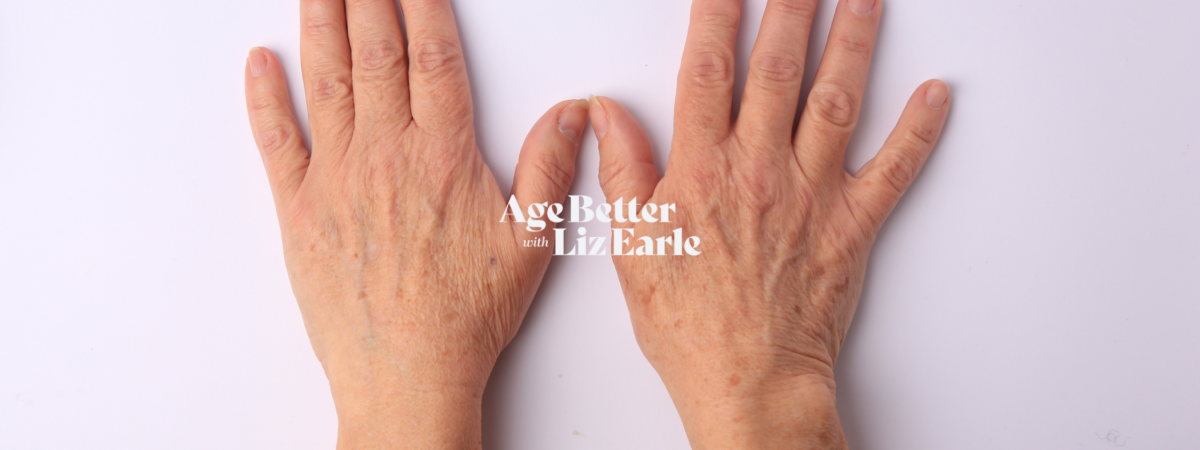 How to fade age spots and pigmentation